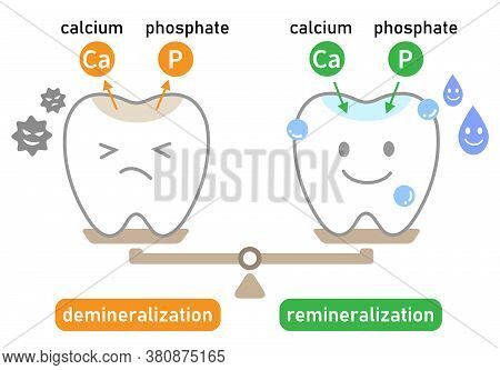 Cute Tooth Demineralization And Remineralization On Balance Scale. Dental Care Concept