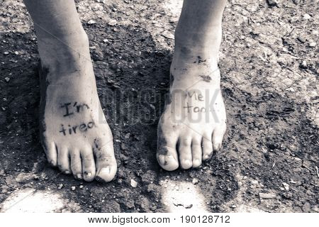 Pair Of Tired Feet