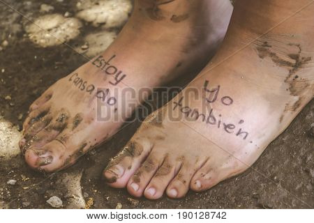 Pair Of Tired Feet