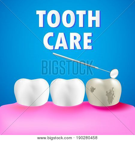 Mouth with healthy teeth and decay tooth with abscess on gum. Dentist mirror. Tooth care concept. Vector illustration