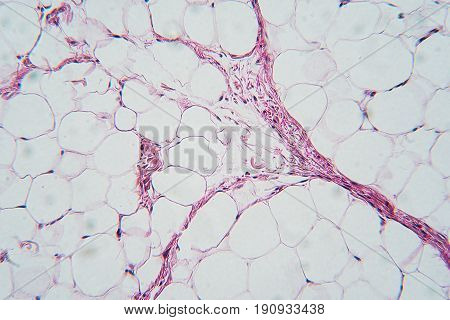 Breast tissue section , microscopic image, color image, microscopic view
