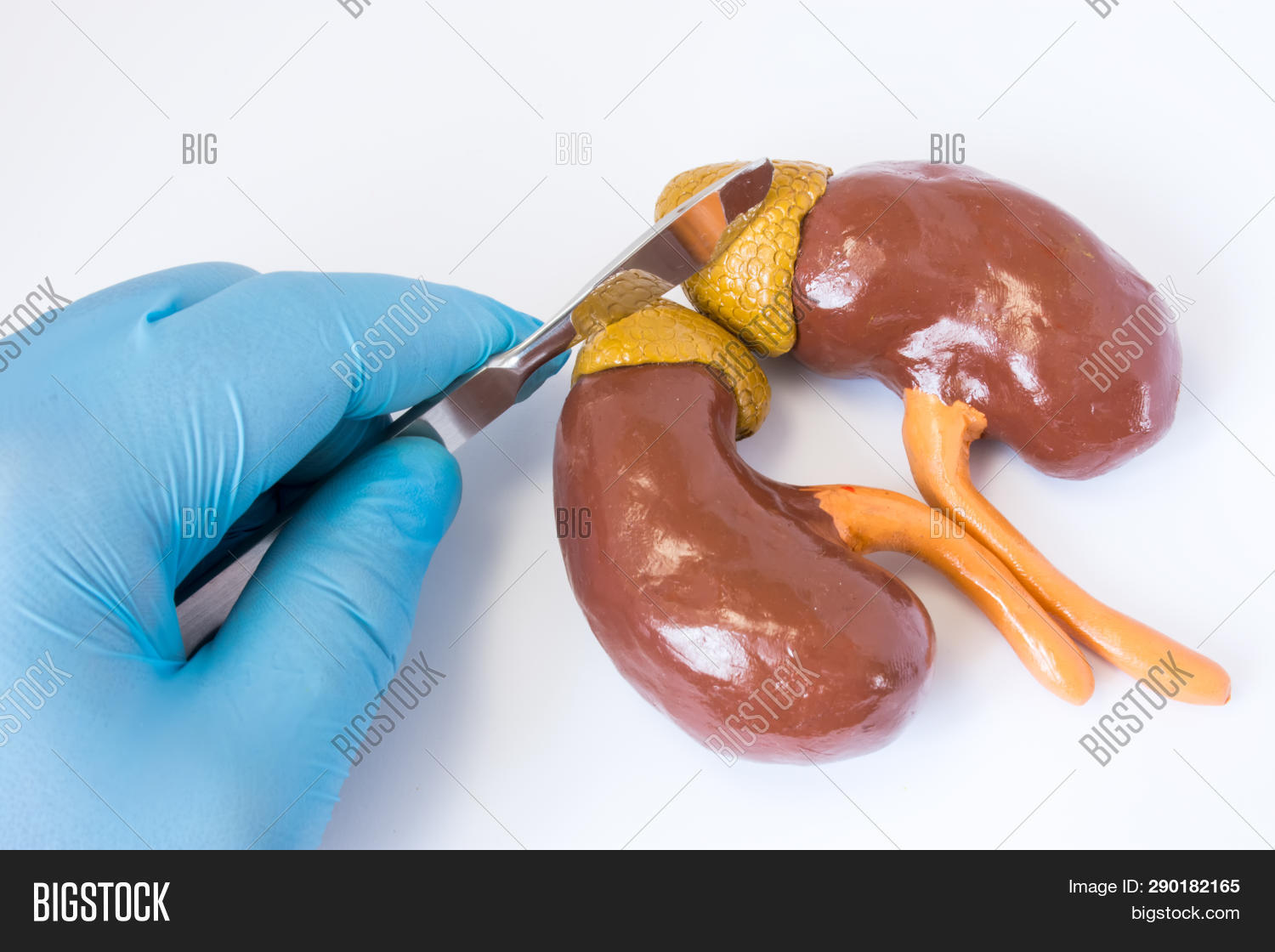 Adrenal Gland Surgery Image & Photo (Free Trial) Bigstock
