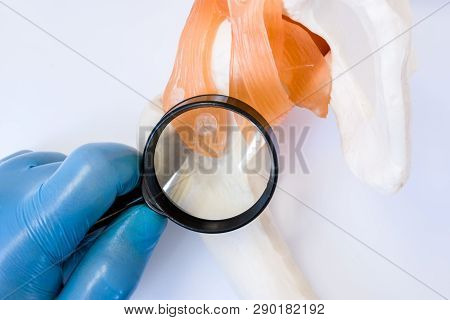 Orthopedic Doctor  Diagnoses Bone And Joints And Other Parts Of Musculoskeletal System For Diseases,
