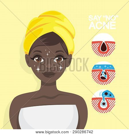 Acne Treatment With Face Mask. Idea Of Beauty