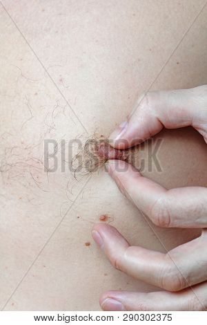 Male Hairy Nipple. Nipple With Hair. Easy Erotica And Humor. Without Epilation. Male Hand. Bdsm
