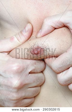 Male Hairy Nipple. Nipple With Hair. Easy Erotica And Humor. Without Epilation. Male Hand. Bdsm