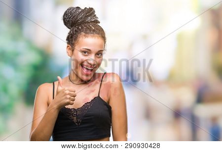 Young braided hair african american with pigmentation blemish birth mark over isolated background doing happy thumbs up gesture with hand. Approving expression looking at the camera