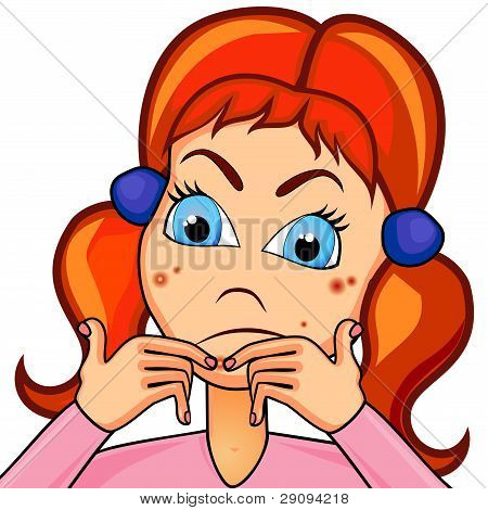 Teenager Girl Struggling With Acne