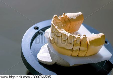 Automatic 3d Dental Scanner For Dental Gypsum Model Scanning And Measuring With Rotating Platform - 