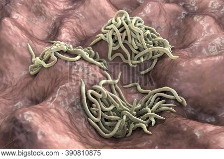 Parasitic Worms, 3d Illustration. Ascaris Lumbricoides, Enterobius Vermicularis And Other Round Worm