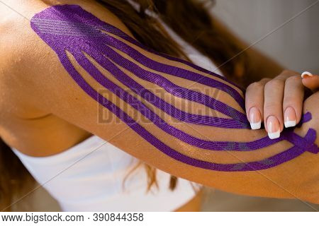 Sporty Girl With Kinesio Tape On Her Arm. Fixation Of The Muscles Of The Biceps With A Plaster For K