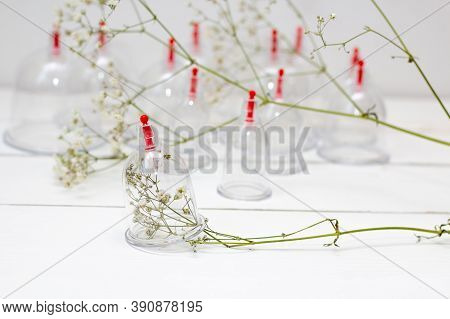 Jars For Hijama On A White Wooden Background And White Flowers. Bloodletting. Sunnah Treatment. Isla
