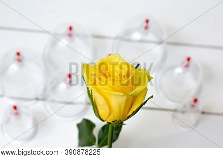 Jars For Hijama On A White Wooden Background And Yellow Flowers. Bloodletting. Sunnah Treatment. Isl
