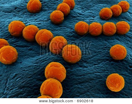 Streptococcus