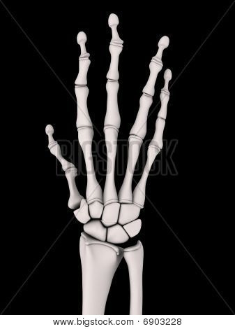 skeletal hand - arthritis