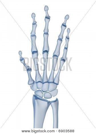 skeletal hand - arthritis