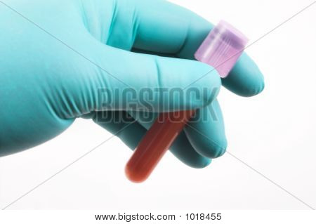 En medicinsk Technicial Holding en blodprøve