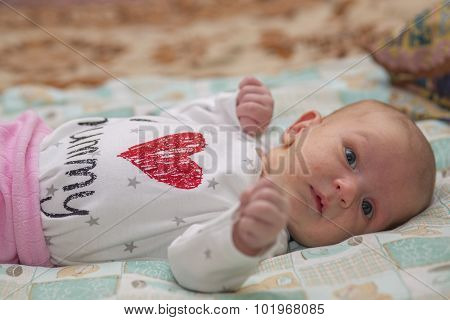 Hormonal rashes in newborns