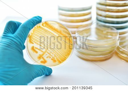 Colonies of bacteria in petri dish (culture media plate)