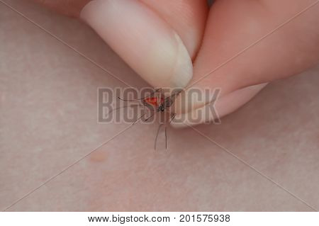 A man holds a mosquito female in his hand close up. The insect made a bite on the skin.