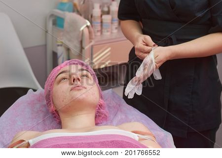 Caucasian woman with problematic skin. Cosmetician putting on gloves.