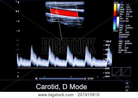 Colourful Image Of Homan Heart Ultrasound Monitor