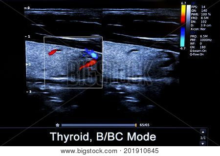 Colourful Image Of Modern Ultrasound Monitor
