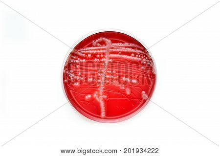 Colonies of bacteria in culture medium plate