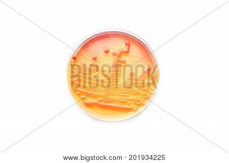 Colonies of bacteria in culture medium plate