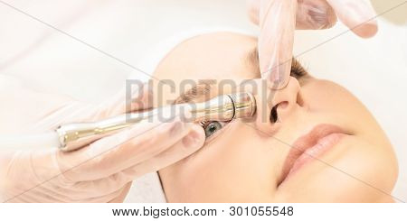 Micro Dermbration Cosmetology Treatment. Facial Diamond Peeling. Anti Acne Procedure. Woman And Doct