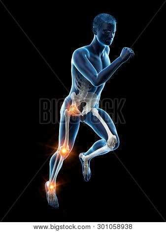 3d rendered medically accurate illustration of a runners painful joints