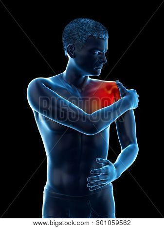 3d rendered medically accurate illustration of a painful elbow