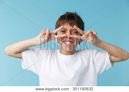 Image of joyous caucasian boy 10-12y with freckles wearing white casual t-shirt and earpods showing peace sign camera isolated over blue background