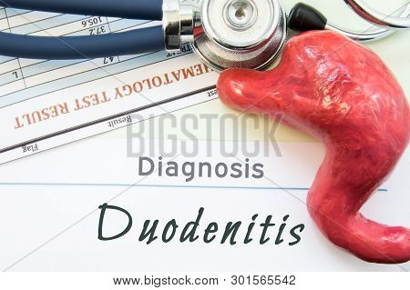 Model Of Stomach, Blood Test And Stethoscope Lying Next To Written Title On Paper Diagnosis Duodenit