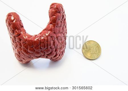 Concept Of Visualization Of Enlarged Thyroid Gland In Various Diseases, Such As Goiter, Thyroiditis,
