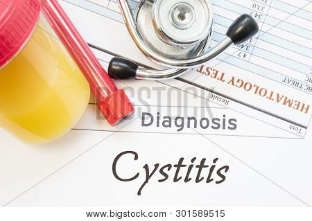 Cystitis Diagnosis. Laboratory Container With Urine Sample, Test Tube With Blood, Stethoscope And Bl