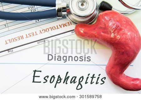 Model Of Stomach, Blood Test And Stethoscope Lying Next To Written Title On Paper Diagnosis Esophagi
