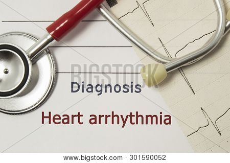 Cardiac Diagnosis Of Heart Arrhythmia. On Doctor Workplace Are Red Stethoscope, Printed On Paper Ecg