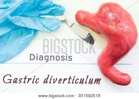 Diagnosis Of Gastric Diverticulum. Figure Stomach, Scalpel And Surgical Gloves Lie Near Title Diagno