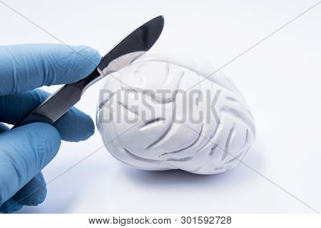 Concept Of Brain Surgery Or Neurosurgery. Neurosurgeon Holding Scalpel In Hand Over 3d Anatomical Mo