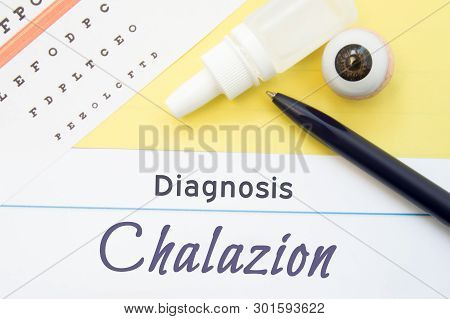 Chart For Testing Visual Acuity, Eye Drops And Eye Anatomical Model Lies Next To Inscription Diagnos