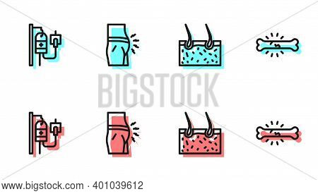 Set Line Hair Covering Skin, Iv Bag, Abdominal Bloating And Bone Pain Icon. Vector