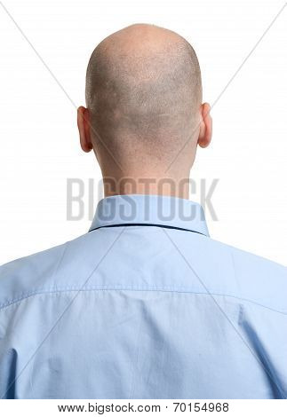 Adult Man Bald Head Rear View