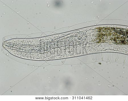 The Head Of Aelurostrogylus Abstrusus, Cat Lungworm