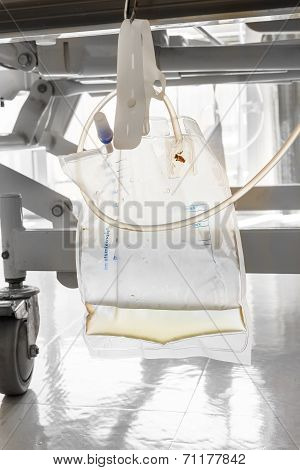 Plastic Urine Bag Hanging Under Patient Bed