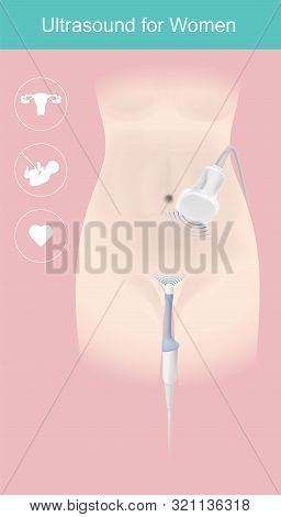Sample Illustrate The Medical Instrument Use Into Obstetrician Department For Women Gender Examinati