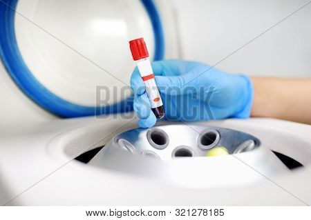 Lab Woman Puts In A Centrifuge Tube Of Blood. General Blood Tests, Biochemistry Tests And Trace Elem