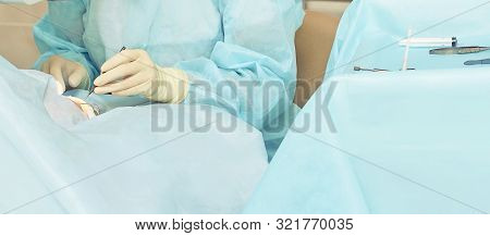 Ophthalmology Laser Microscope Operation. Doctor In Clinic. Patient Eye Treatment. Myopia And Catara