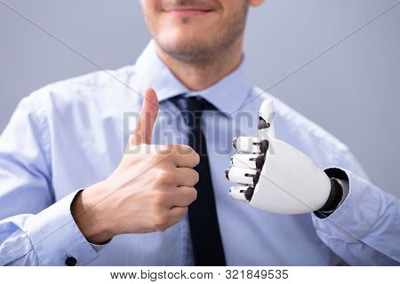 Businessperson With Prosthetic Limb Showing Thumb Up. Artificial Limb
