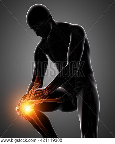 3d Rendering Human Knee Pain With The Anatomy Of A Skeleton Leg